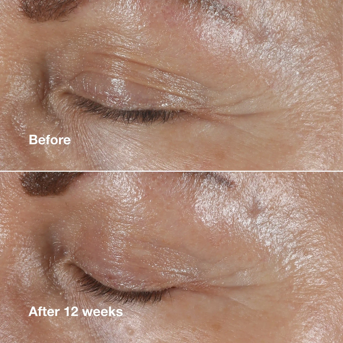 Clinique Smart Clinical Repair™ Wrinkle Correcting Eye Cream