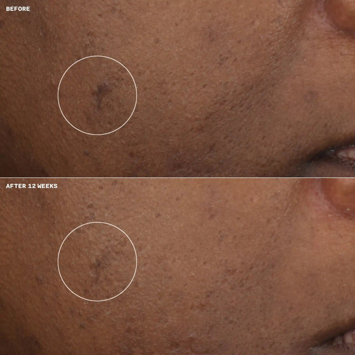 Even Better Clinical™ Brightening Moisturizer